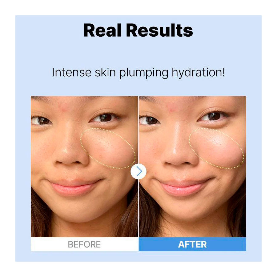 the-hyaluronic-acid-3-serum-hydraterende-gezichtscreme