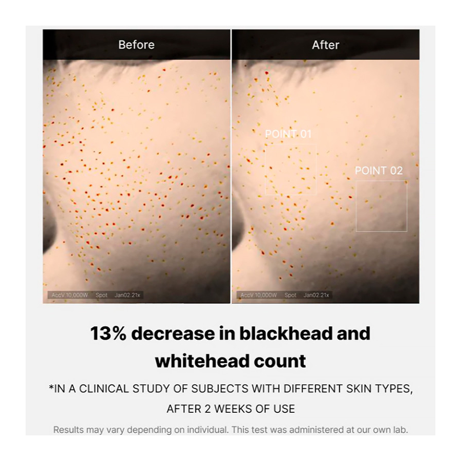 zero-pore-one-day-serum-serum-facial-exfoliante-limpiador