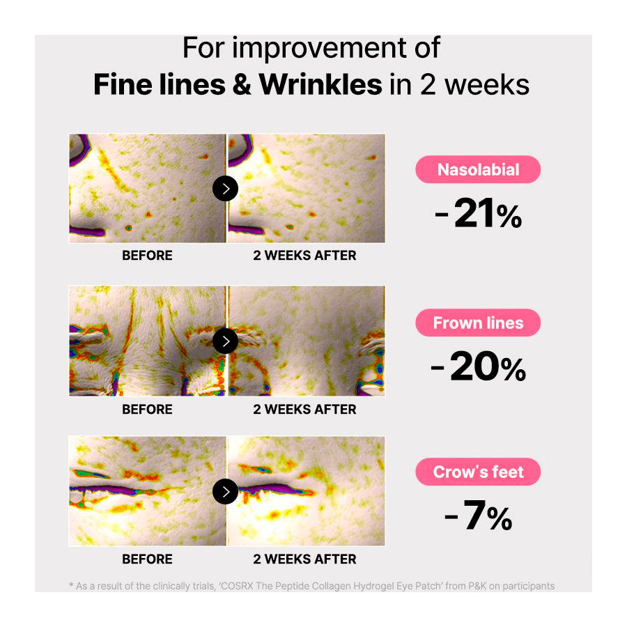 the-peptide-collagen-hydrogel-eye-patch-hydrogel-patches