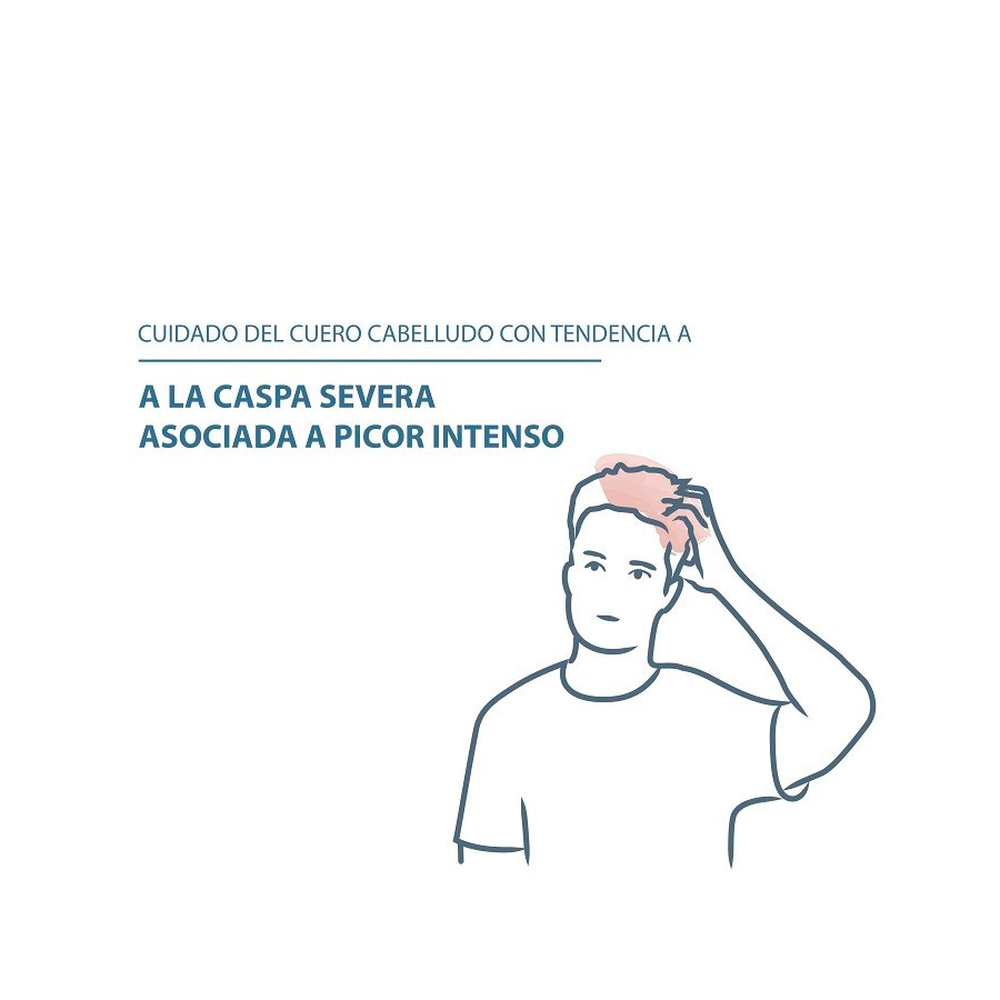 kelual-ds-behandlungsshampoo kelual-ds-behandlungsshampoo