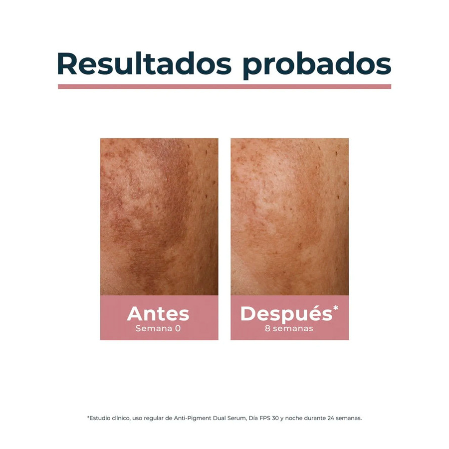 anti-pigment-crema-de-noche