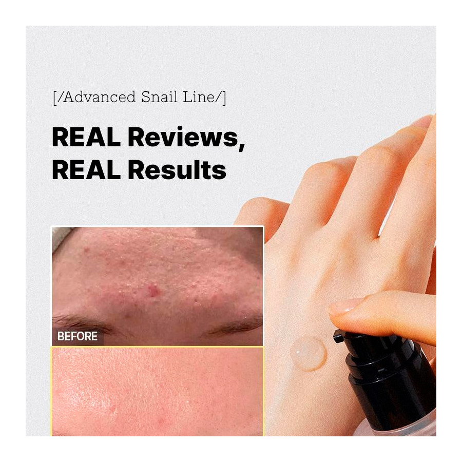 advanced-snail-96-mucin-power-essenz-regenerative-behandlung-anti-falten advanced-snail-96-mucin-power-essenz-regenerative-behandlung-anti-falten