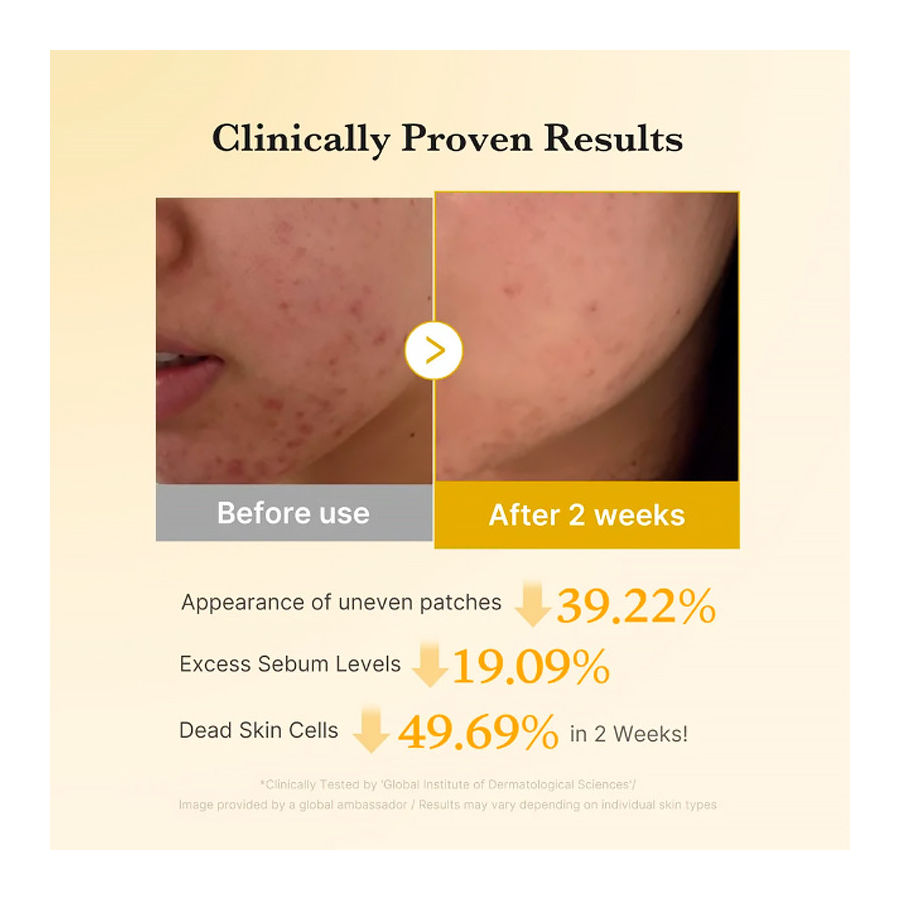 kojic-acid-turmeric-pad-almohadilla-tonica-de-acido-kojico-y-curcuma